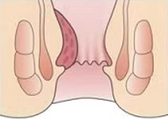 ジオン注を投与すると、どうなるのでしょうか？
