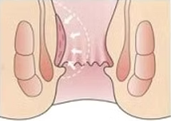 ジオン注を投与すると、どうなるのでしょうか？